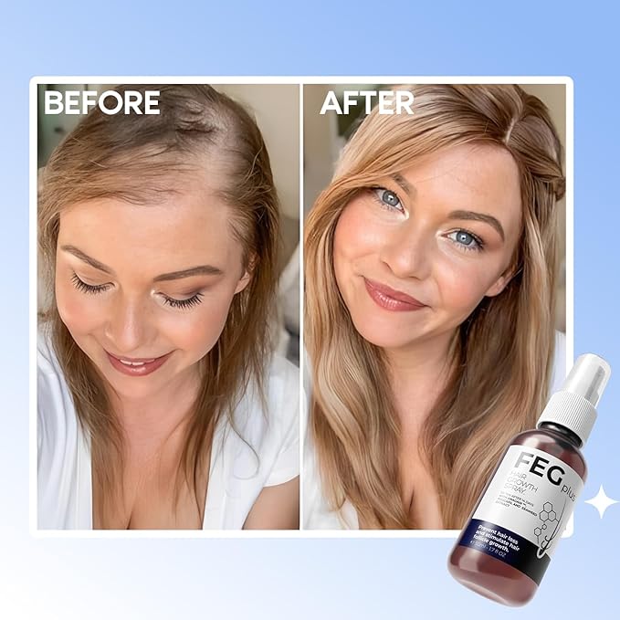 FEG Hair Growth Spray PLUS